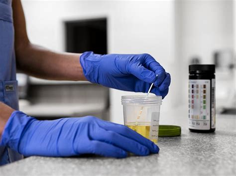 does duromine come up in a drug test|Urine drug tests: Uses, procedure, detection times, and .